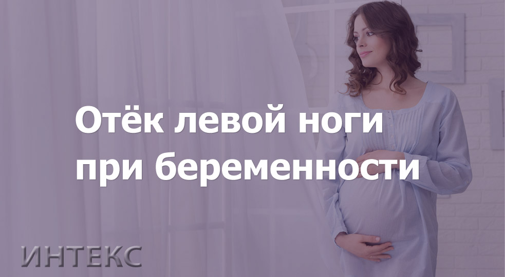 Отёки ног при беременности - «Институт Вен» лечение варикоза в Киеве и Харькове